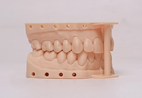 DM100修复牙模树脂优质作品展示