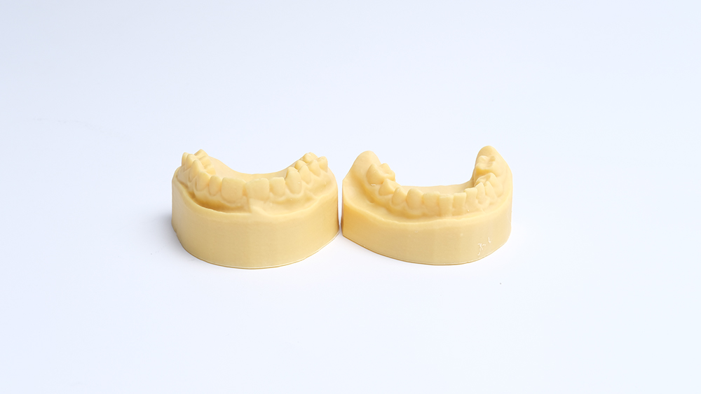 Dental Model Resin_Print model