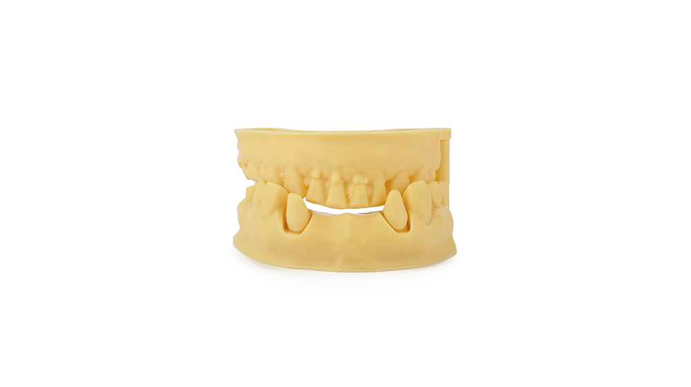 Dental Model Resin_Print model_2